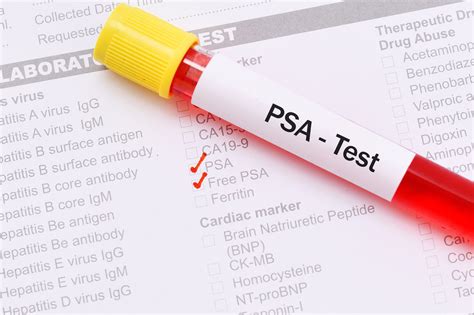 PSA test .
